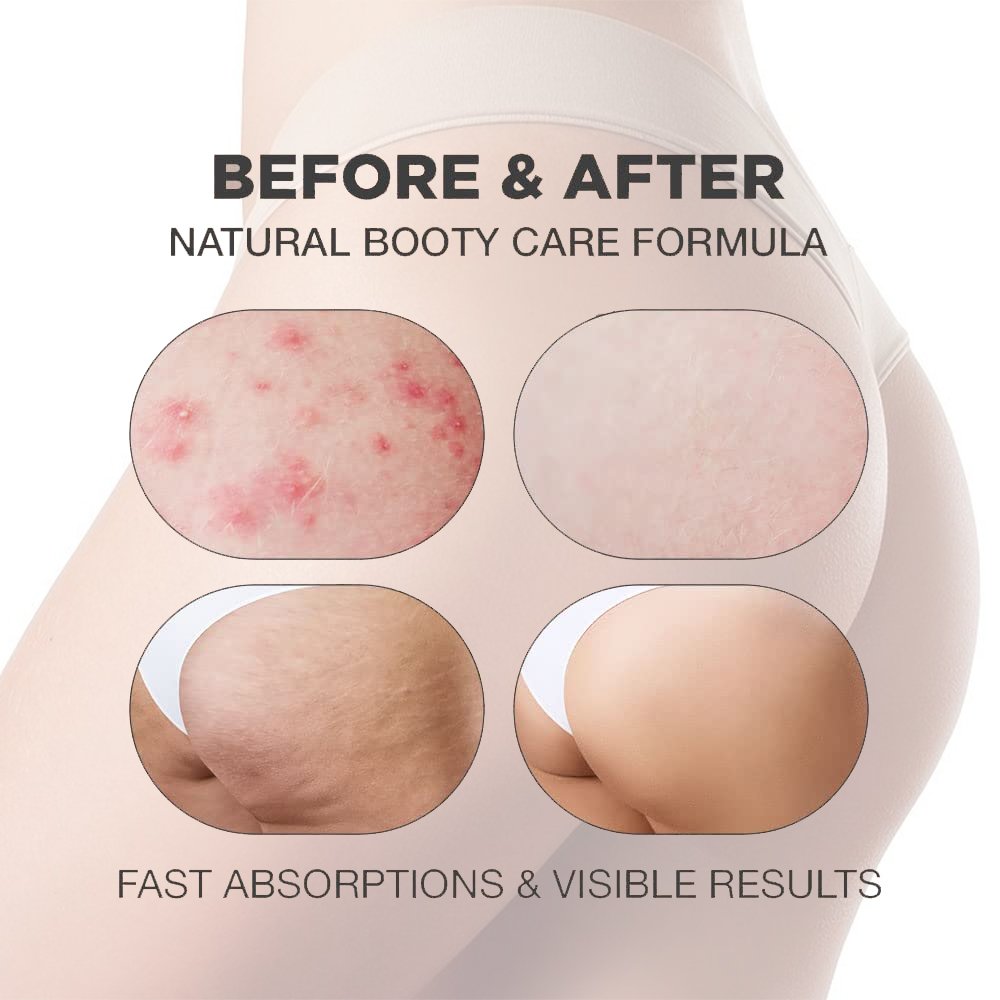 Private Label Hydrating Nourishing Whitening Body Butt Acne Lotion