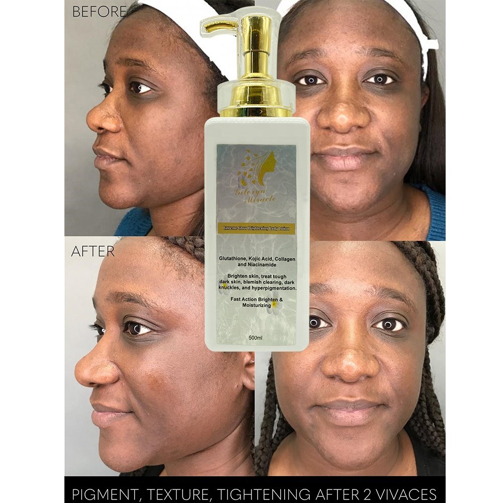 Private label lait de corps blanchissante skin care smoothing bleaching brightening beauty body lotion for black skin