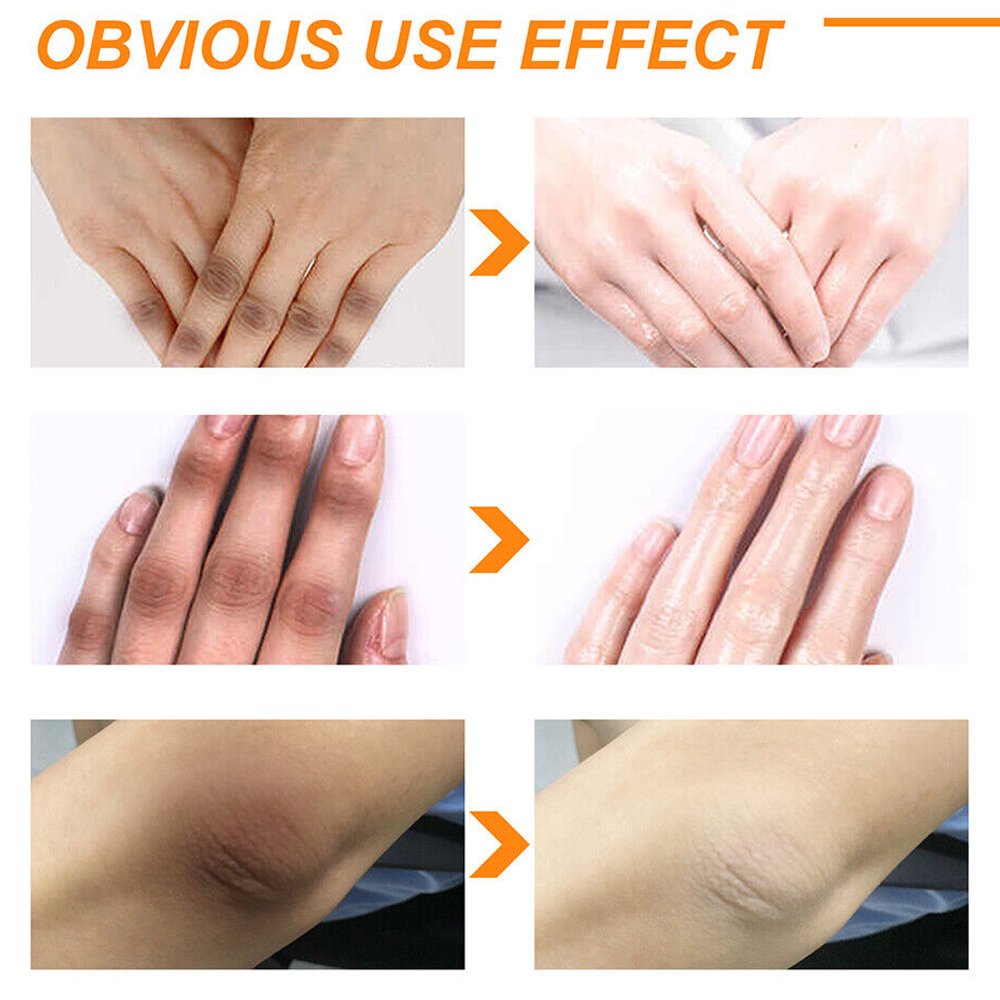 Private Label Dark knees knuckles elbows armpit whitening cream serum skin care knuckle strong whitening for dark skin