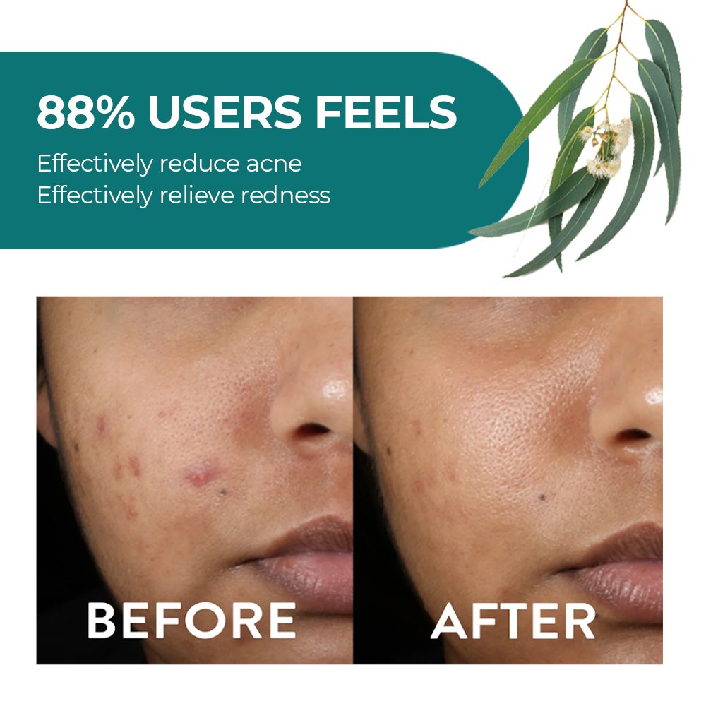 Private Label Women's Body Care Natural Eucalyptus Mint Moisturizing Lotion Nourishing Dry Skin Featuring Shea Butter Aloe Vera