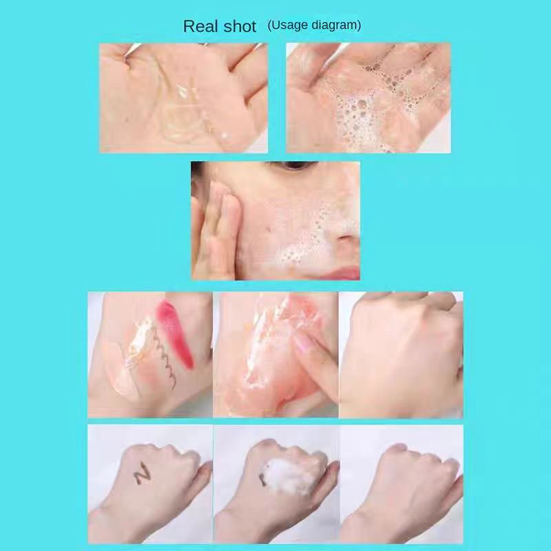 Gentle Face & Body Acne Cleanser Acne Treatment Clears Pimples, Blackheads, Chest & Back Acne