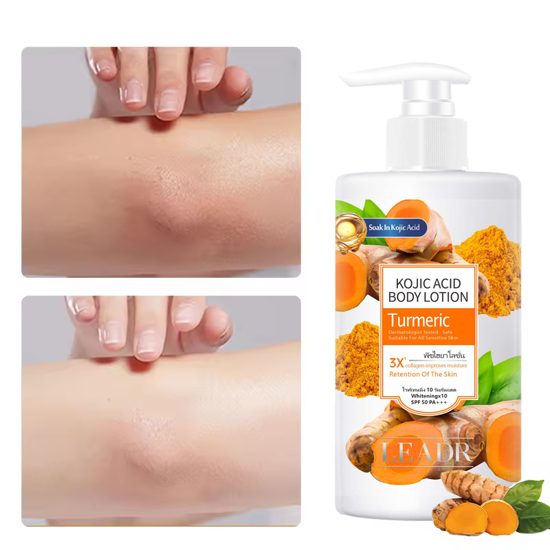 Private Label 300ml Men Women Anti Dark Spots Moisturizing Whitening Vitamin C Turmeric Kojic Acid Body Lotion