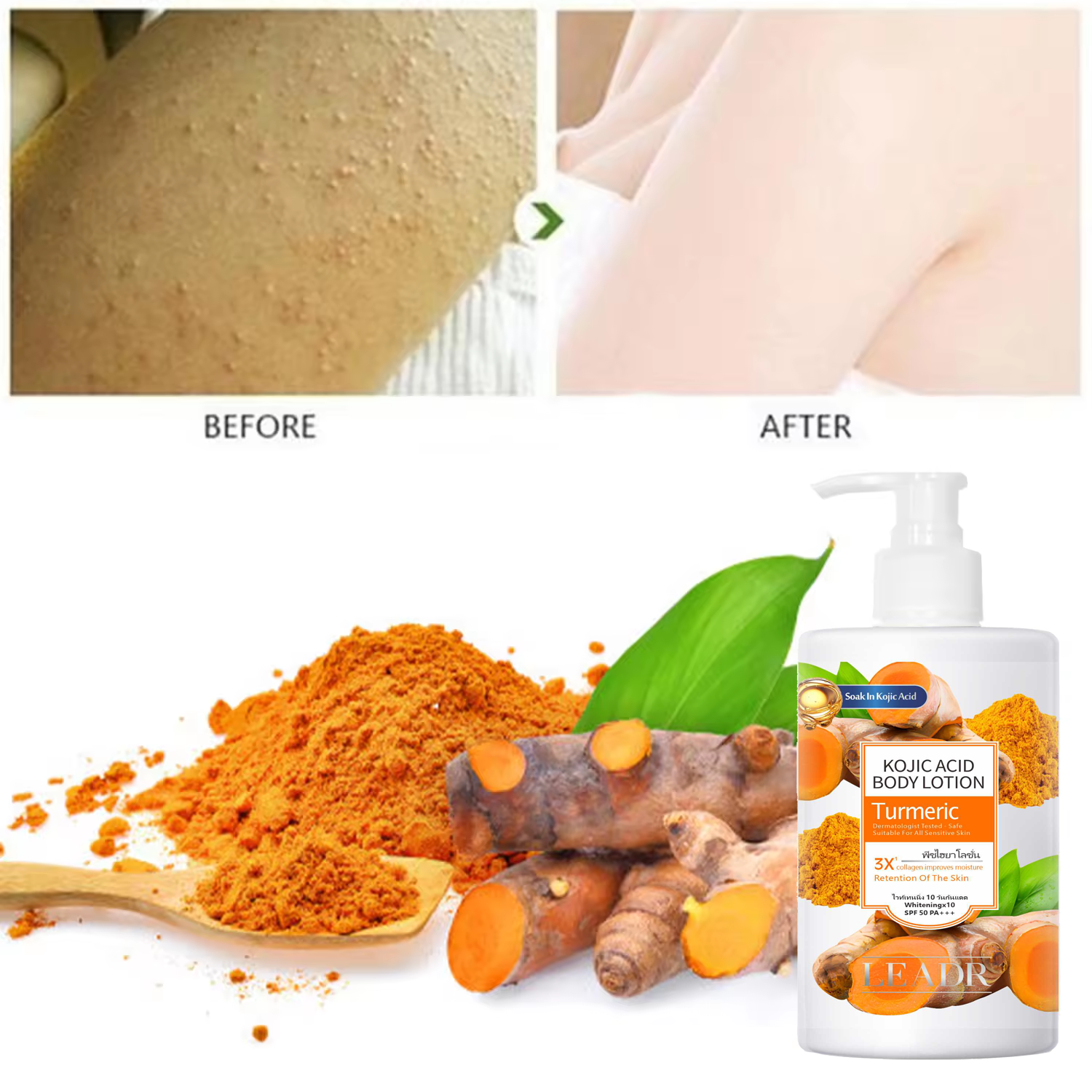 Private Label 300ml Men Women Anti Dark Spots Moisturizing Whitening Vitamin C Turmeric Kojic Acid Body Lotion