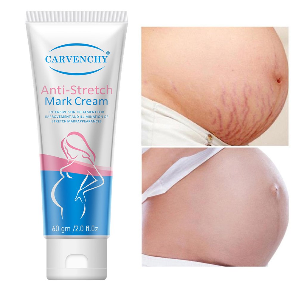 High quality body whey Cool non-greasy moisture to grow lines Wholesale Stretch mark cream 60g
