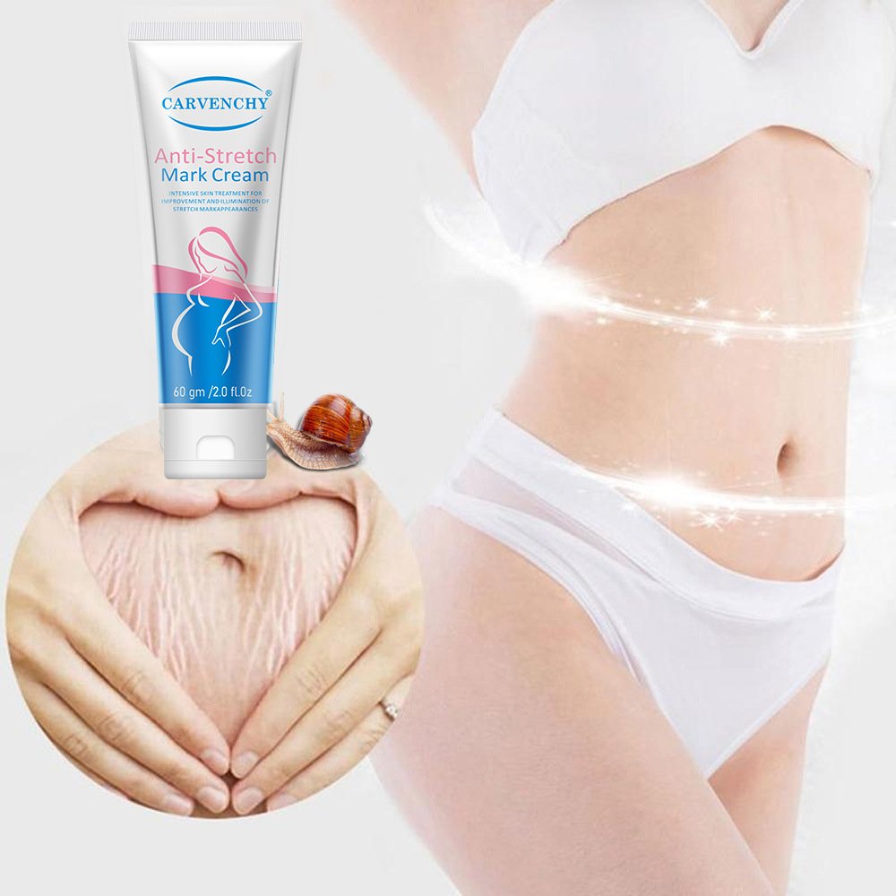 High quality body whey Cool non-greasy moisture to grow lines Wholesale Stretch mark cream 60g