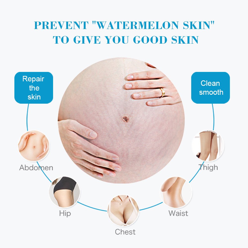 High quality body whey Cool non-greasy moisture to grow lines Wholesale Stretch mark cream 60g