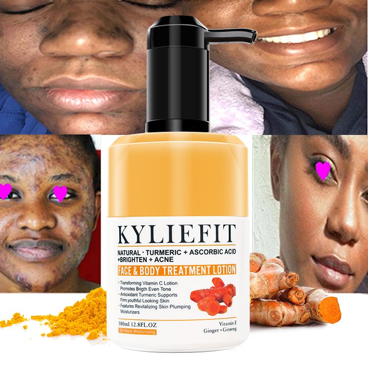 Body Butter Custom Best Whitening Turmeric Shea Butter brightening and acne removal Turmeric body lotion for men