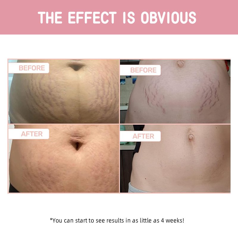 Private Label B-Flat Firming Belly Cream Smoothing Tightening Lift Stretch Mark Removal Cream Moisturizing Body Massage Lotion