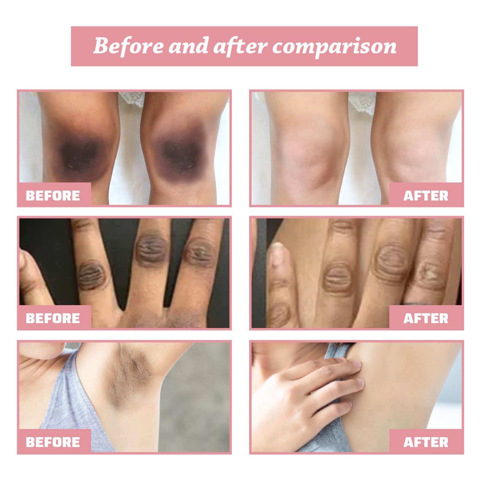 korean skin brightening lotion body Arbutin black skin care products whitening moisturizer body lotion cream