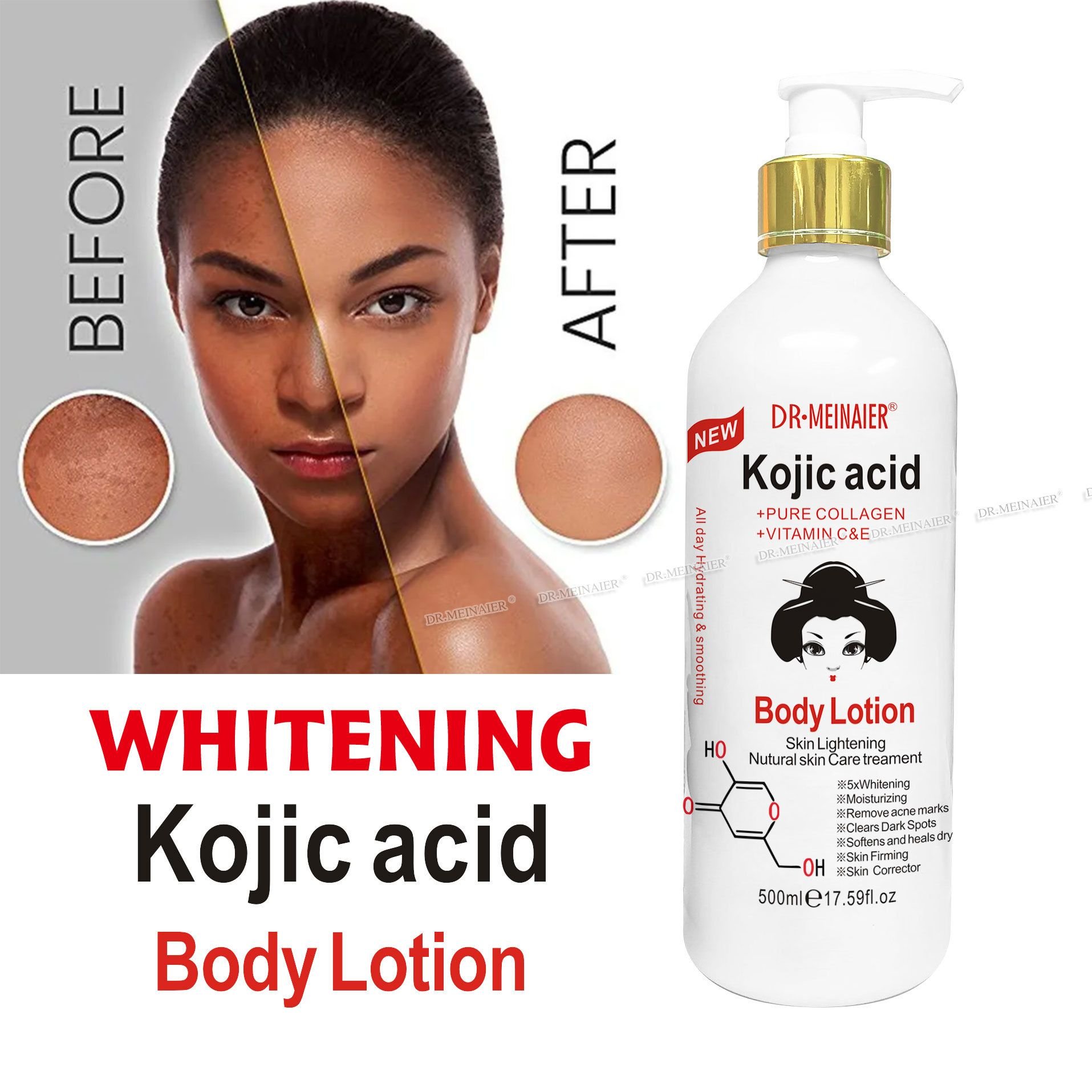 Kojic Acid Body Lotion Body Moisturizer Lotion Body Lotion Private Label