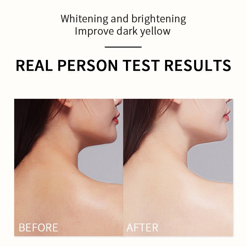 Wholesale long-last moisturizing skin thailand vitamin c whitening body lotion product the with niacinamide