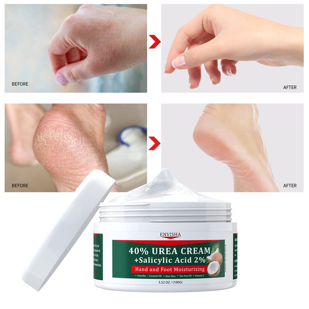 Hight Quality Organic Vegan Body Care Cream Herbal Moisturizing Hand And Foot 40% Urea Body Cream Lotion With Salicylic Acid 2%