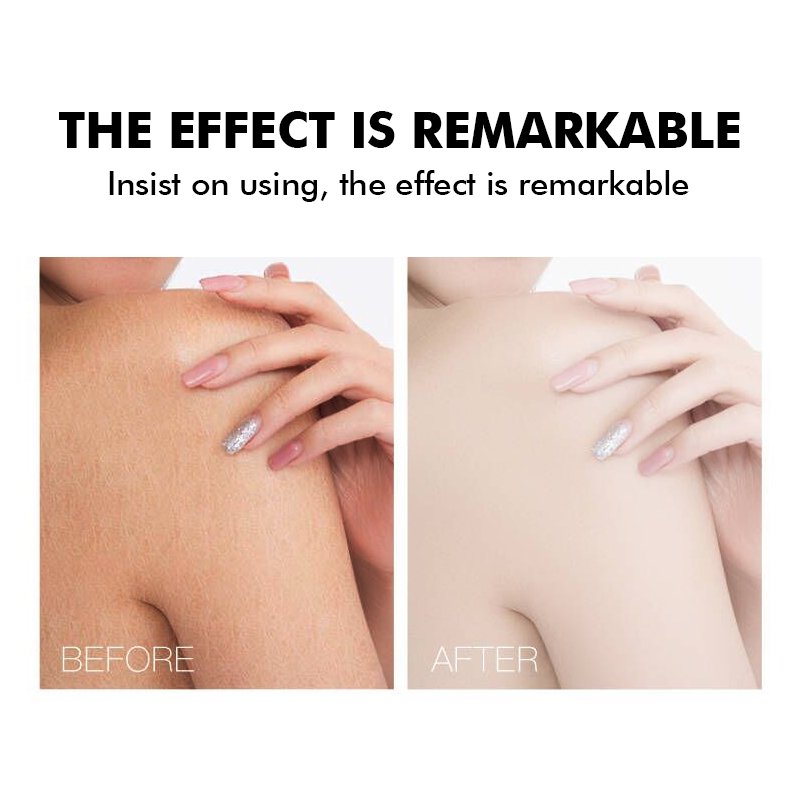 Wholesale private label vegan skin care anti dead skin moisturizing body repair whitening lotion