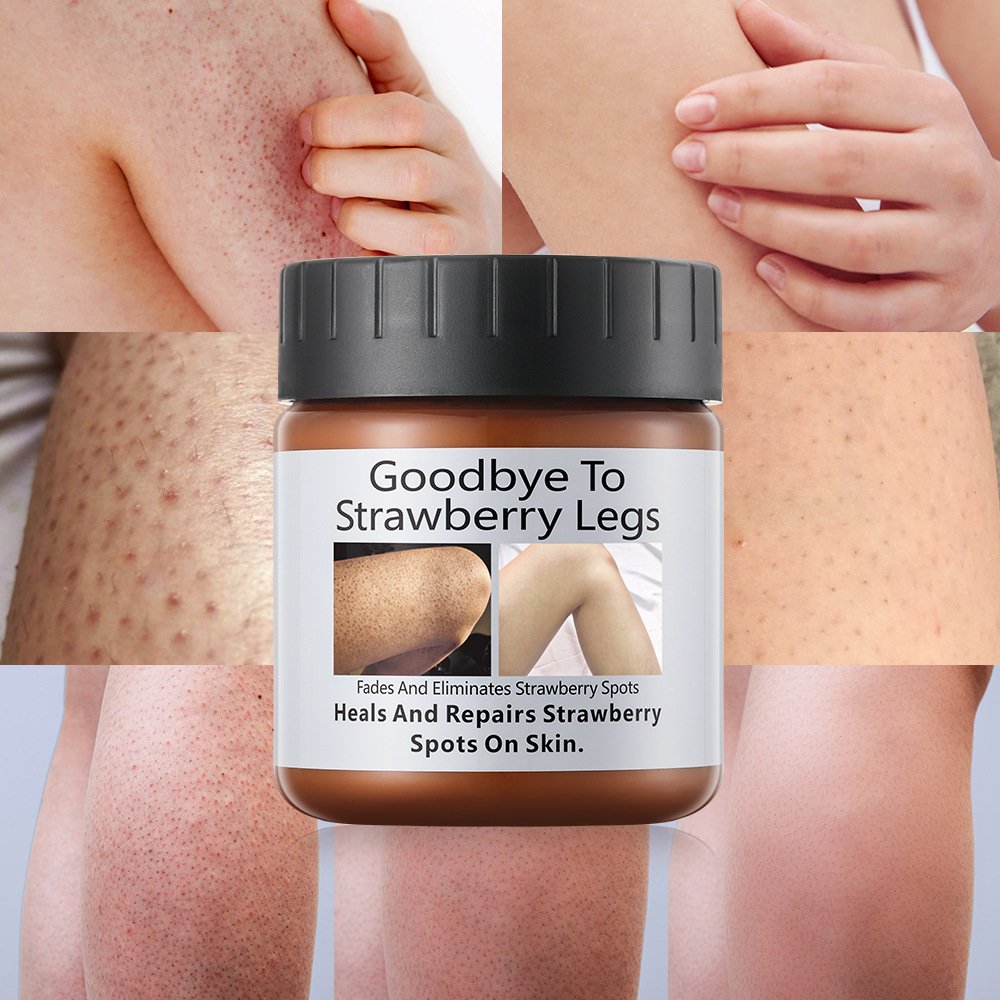 New Product Whitening Cream Repair and cure Elastic and smooth skin Strawberry Spotted Legs Bleaching Cream