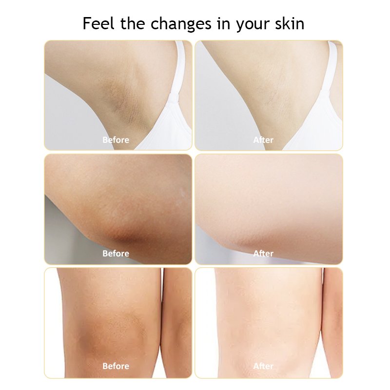 Underarm Cream Instant Result Dark Spot Remover Dark Armpit Remover, Moisturizes for Intimate Areas Armpit