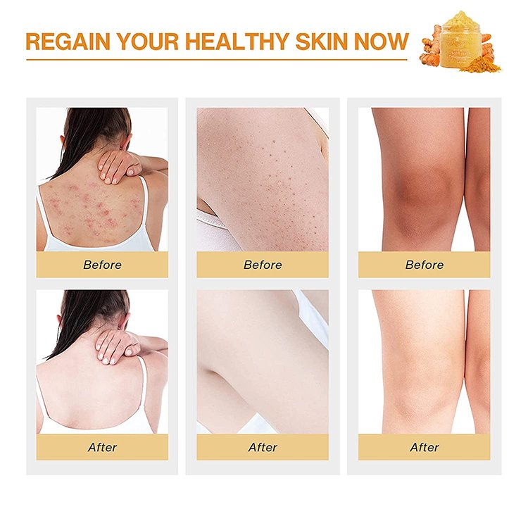 Trending Products 2023 Body Scrub Cruelty-Free Exfoliating Whitening and Shea Butter Fruit Body Scrubs