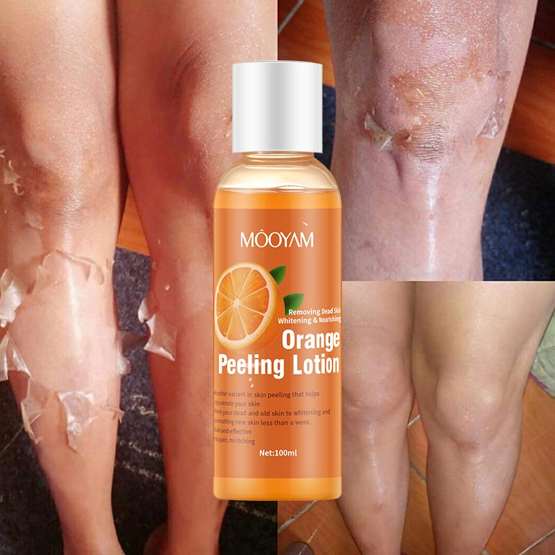 Private Label Natural Body Yellow Peel Off Lotion Remove Dark Skin Whitening Repair Orange Peeling Lotion