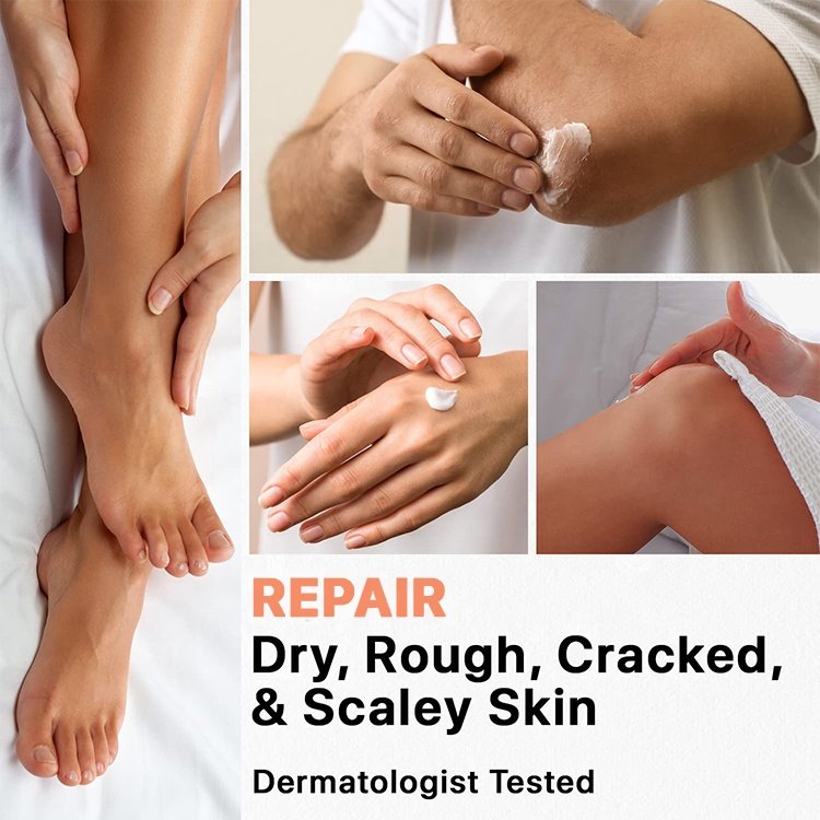 Private Label Urea Body Lotion Moisturizing Repair Dry Rough Cracked Skin Best Exfoliating Cocoa Butter Body Cream Set