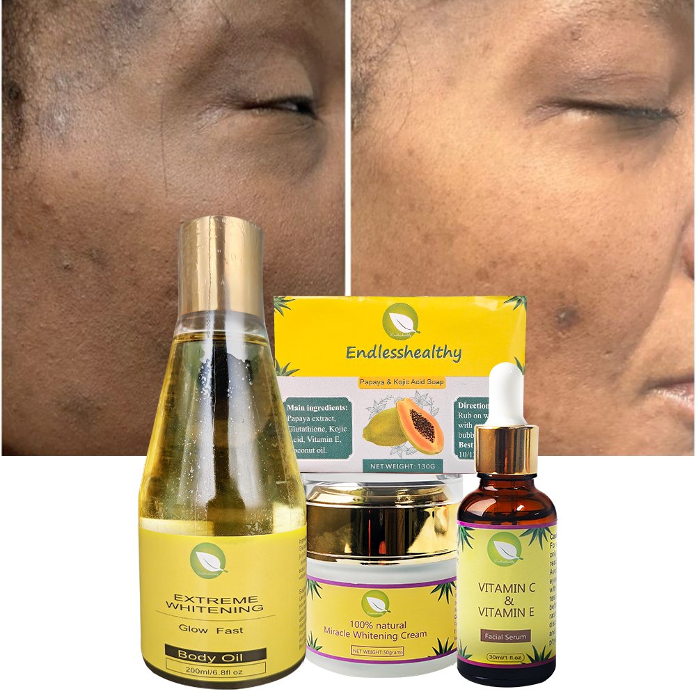 Brightening Skin Beauty Product Face Anti Aging Remove Dark Spot Whitening Body Moisturizing Rejuvenating Skin Care Set
