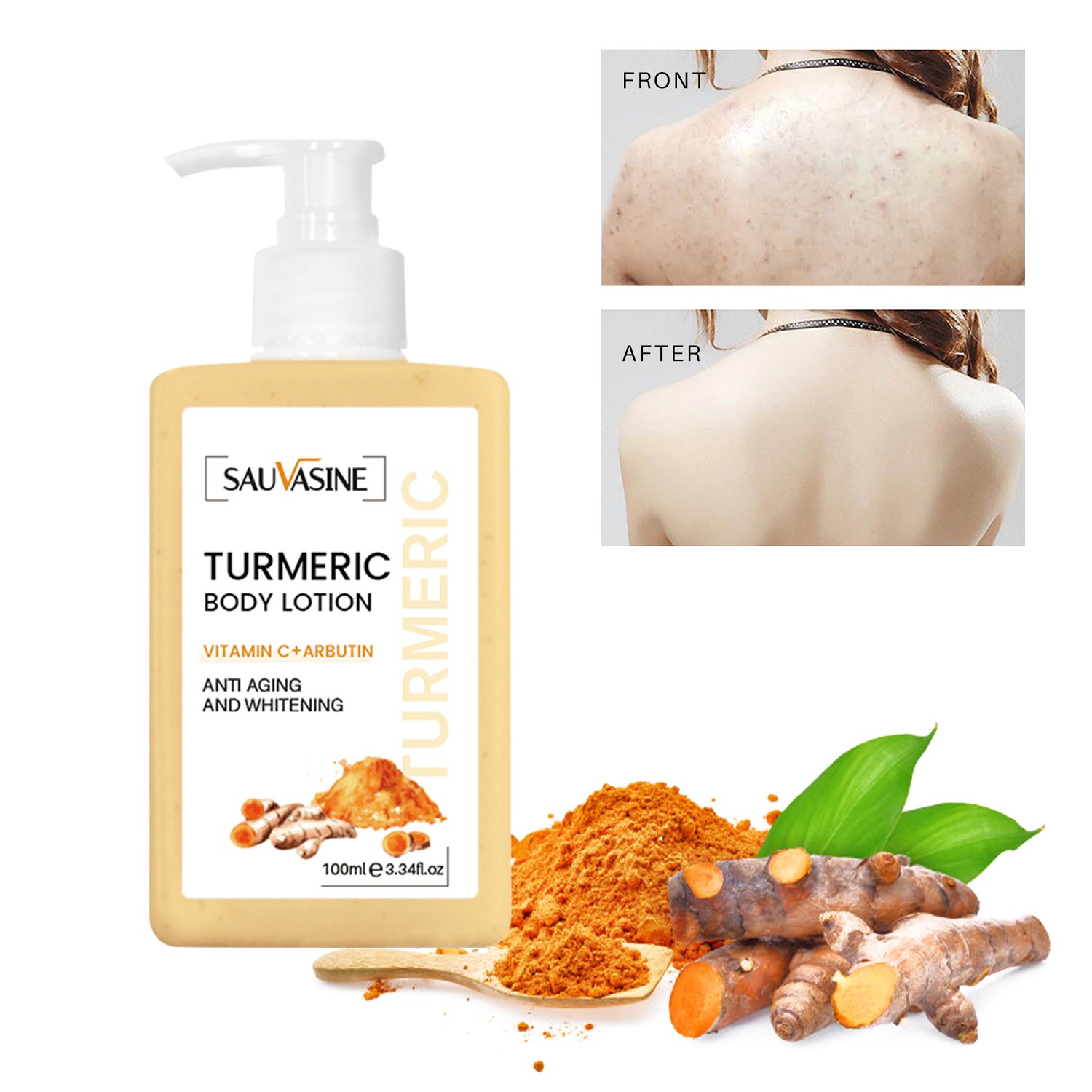 OEM Private Label Remove Dark Spot Acne Treatment Fast Results Skin Whitening Lightening Body Lotion For Men Women