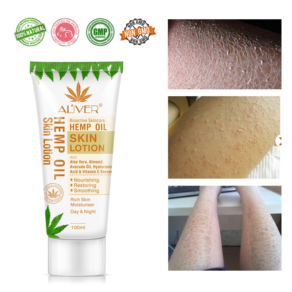 ALIVER High Quality Vitamin C Bioactive Skincare Hemp Oil Cream Dry Skin Smoothing Moisturizer Whitening Body Lotion