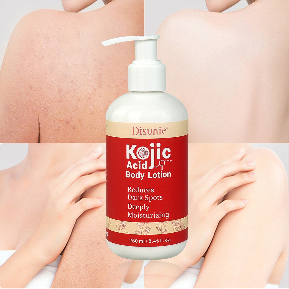 Kojic Acid Cream Body Lotion Skin Whitening Products Scar Reducing Creams Anti Black Spots Dark Spot Skin Even Skin Tone Lotion