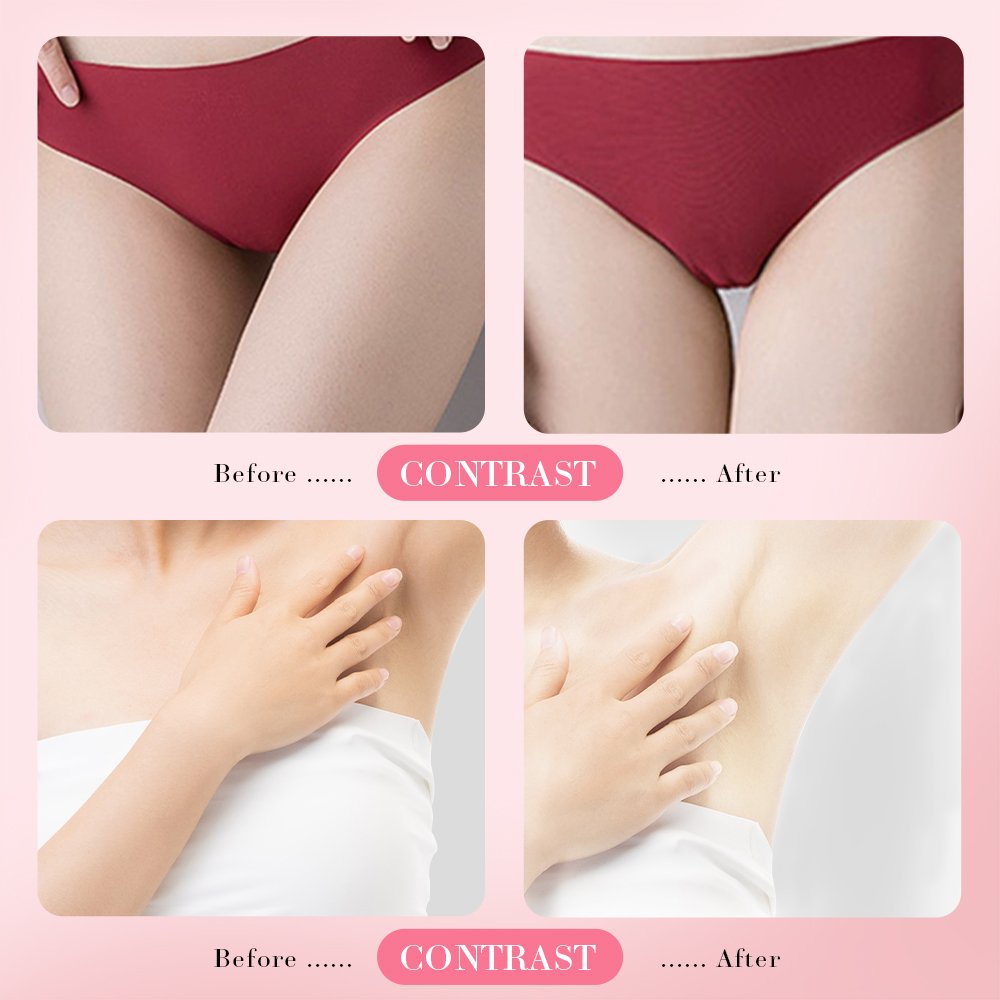 SADOER Lips hygiene Gel care lightening whitening feminine part pink body lotion for skin care