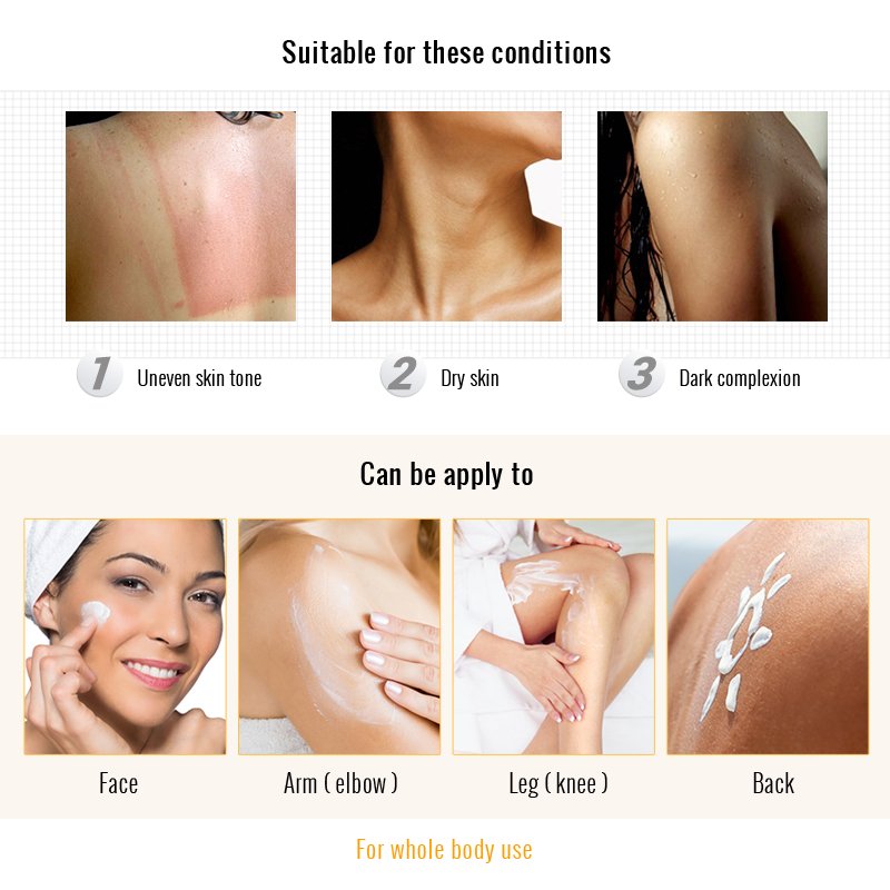 Advanced Whitening Treatment Cream Skin Whitening Body Lotion Adults Female Whitening Lotion Alibaba Online Shopping Website