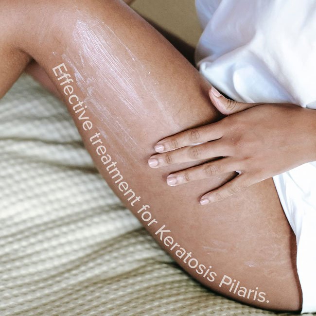 Private Label OEM Exfoliator Body Lotion Keratosis Pilaris Treatment Dry Skin Moisturizer 12% Lactic Acid Body Lotion