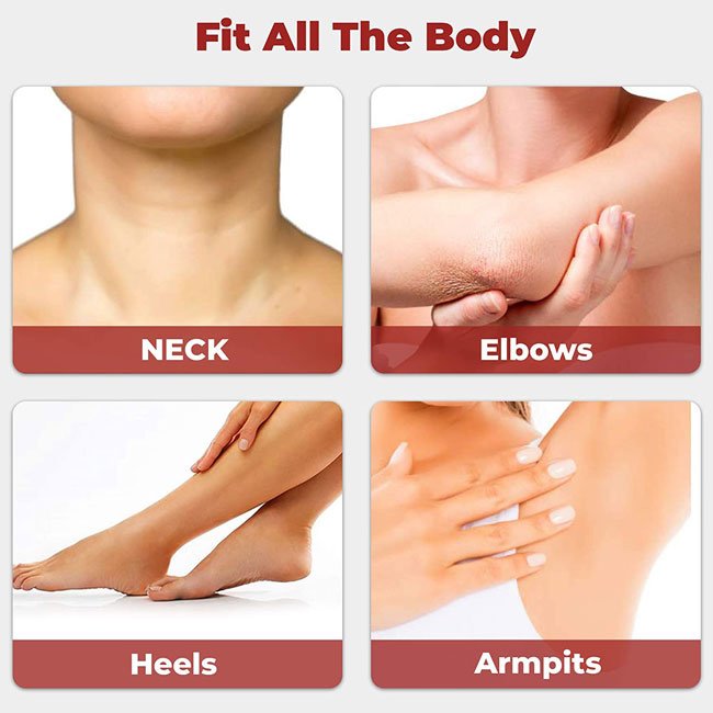 Private Label OEM Exfoliator Body Lotion Keratosis Pilaris Treatment Dry Skin Moisturizer 12% Lactic Acid Body Lotion