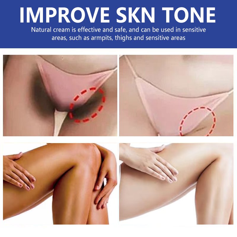 New Arrival Niacinamide Dark Knees Knuckles Elbows Armpit Whitening Cream,Woman Private Parts Bleaching Cream For Dark Skin