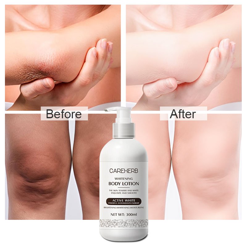 Halal Black Skin Brightening Lightening Dark Skin Bleaching Cream Body Whitening Lotion