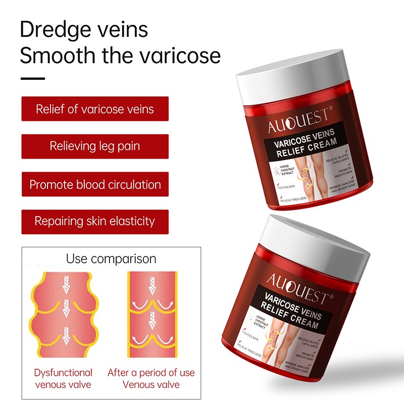 Health Care Body Cream for Varicose Veins Treatment Herbal Extract Chinese Herbal Medicine Relieve Skin Care