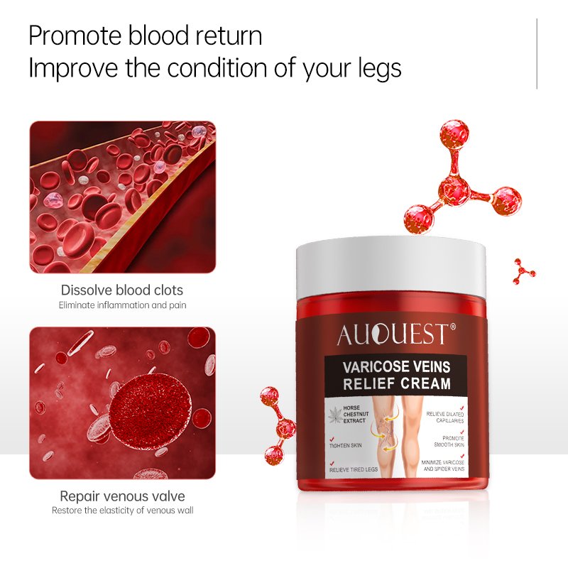 Health Care Body Cream for Varicose Veins Treatment Herbal Extract Chinese Herbal Medicine Relieve Skin Care