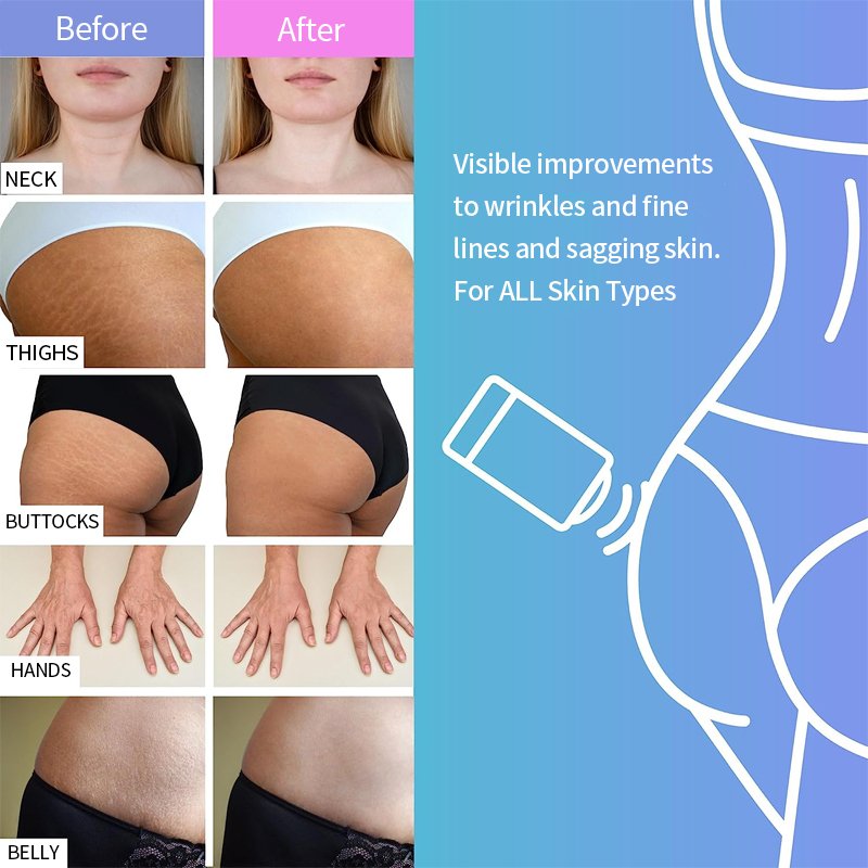 Custom solid body cream balm moisturizing firming glow retinol body lotion stick