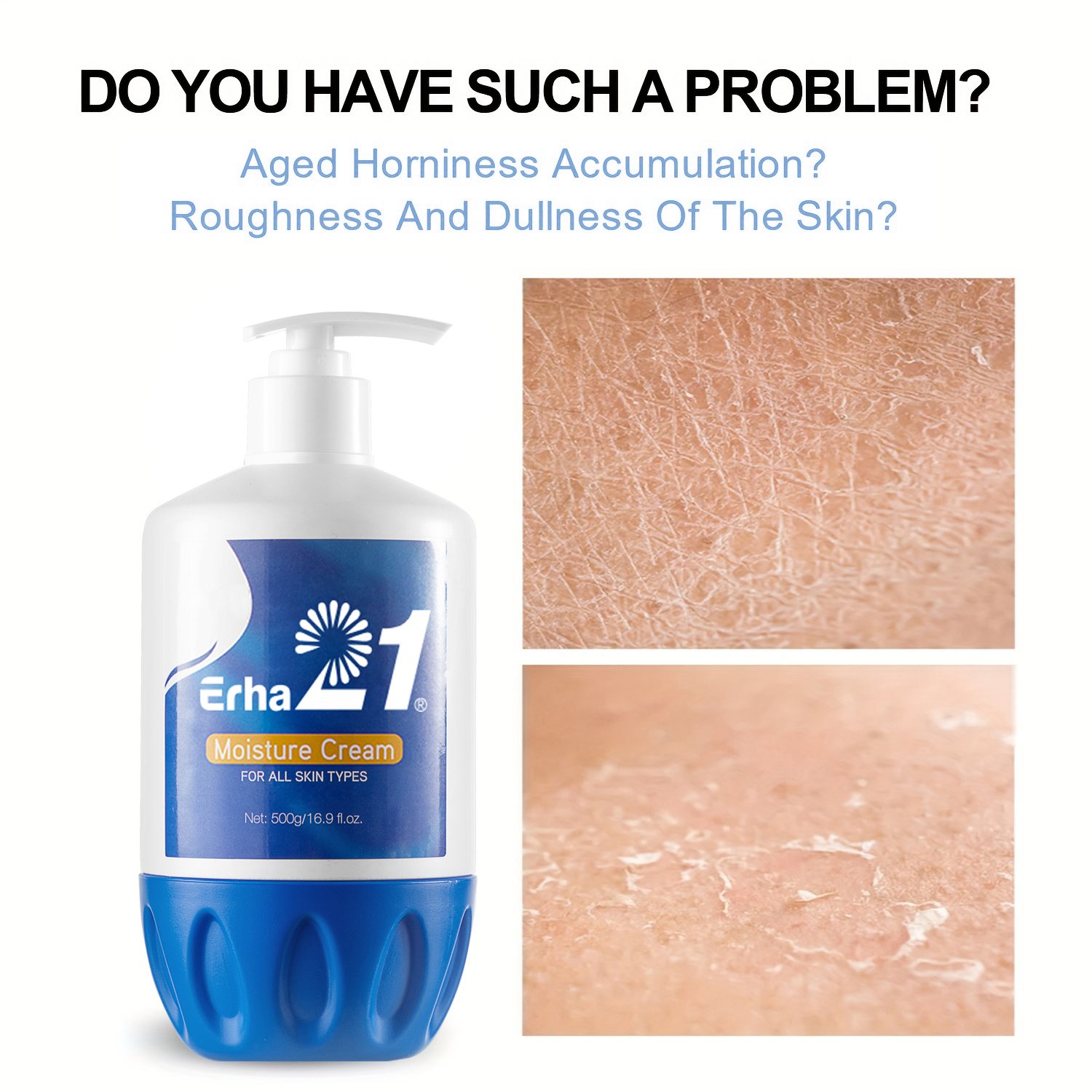 Erha21 wholesale direct factory Skin Care Body Cream Lotion Dry Sensitive Skin Repair Effects moisturizing cream