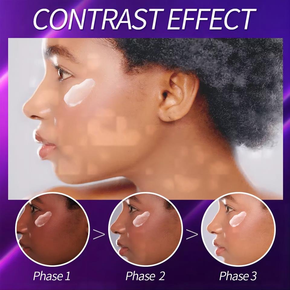 Private Label Skin Whitening Dark Spot Serum Face Cream Kojic Acid Soap Bleaching Body Lotion SkinCare Set For Dark Skin Women