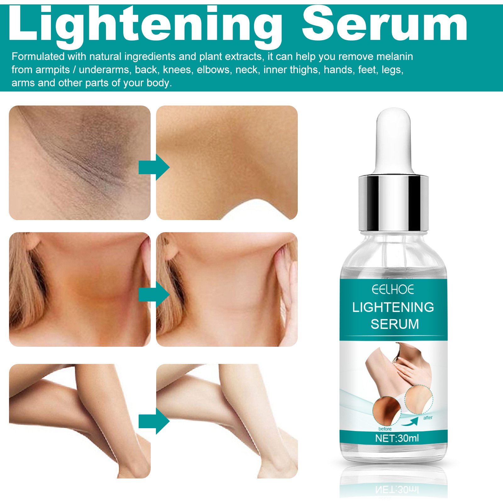 Retinol Whitening Oil For Private Part Brighten Dark Skin Permanent Bleaching Lotion for The Whole Body Underarm Knee Buttocks