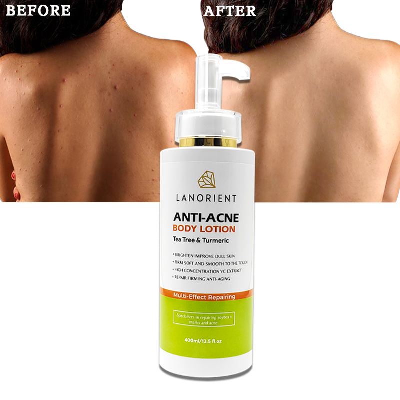 Private Label LANORIENT Natural Organic Vitamin C Turmeric Dark Spot Removal 24 Hour Moisturizing Whitening Body Lotion
