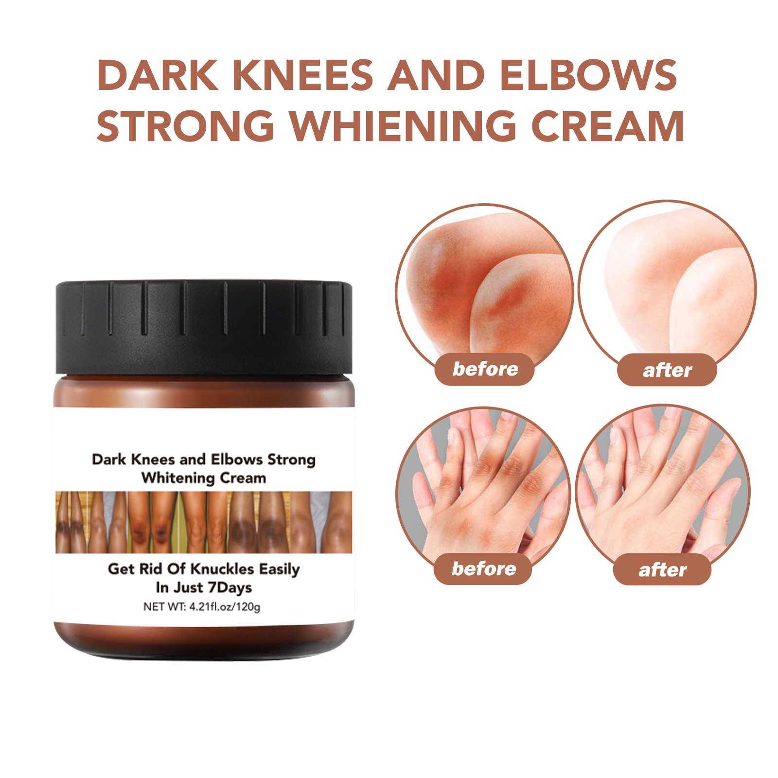 Fair white wholesale natural knee and elbow body fast skin care day and night bleaching popular booty moisture whitening cream