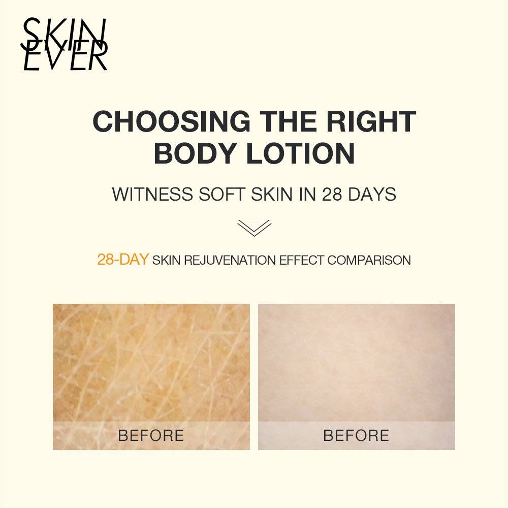 SKINEVER Whitening Body Lotion Cream Organic Vitamin C Milk Glycerin Collagen Butter Lightening Cream Coconut Oil Free Adults