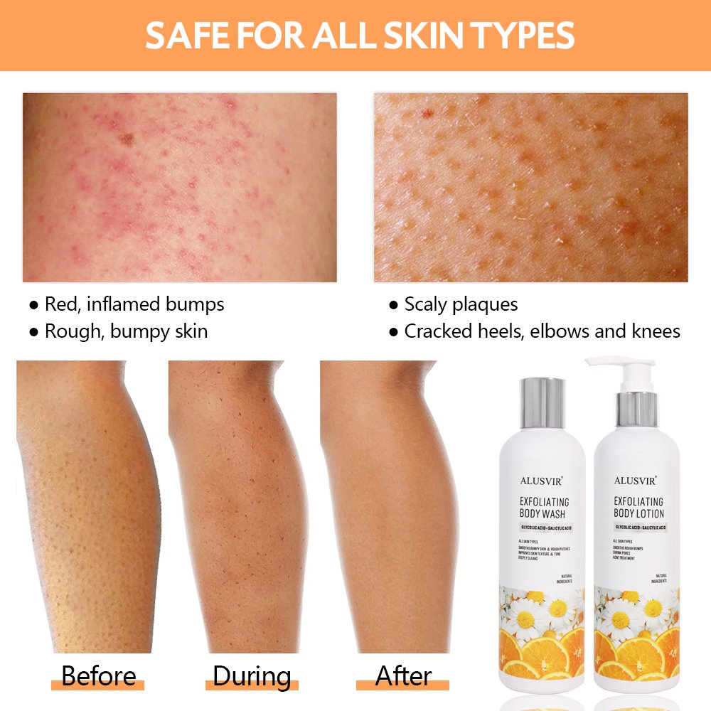 12% Glycolic Acid 2% Salicylic Acid Remove Dead Body Skin Lightening Smoothing Whitening Exfoliating Orange Peeling Body Lotion