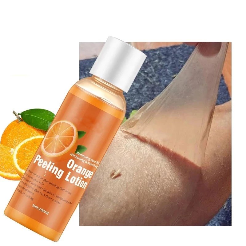 Customized OEM ODM Vitamin C Orange Peeling Lotion For Removing Dead Skin And Whitening Smoothing New Skin Perfect White Lotion