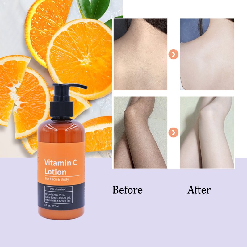 Best Korean 400ml natural no side effects skin cream strong bleaching whitening body lotion for dubai african black skin