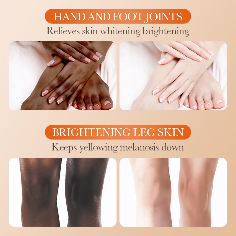SADOER OEM Strong Whitening Knee Joint Armpit Remove Black Spots Whitening Body Lotion Cream For Dark Skin