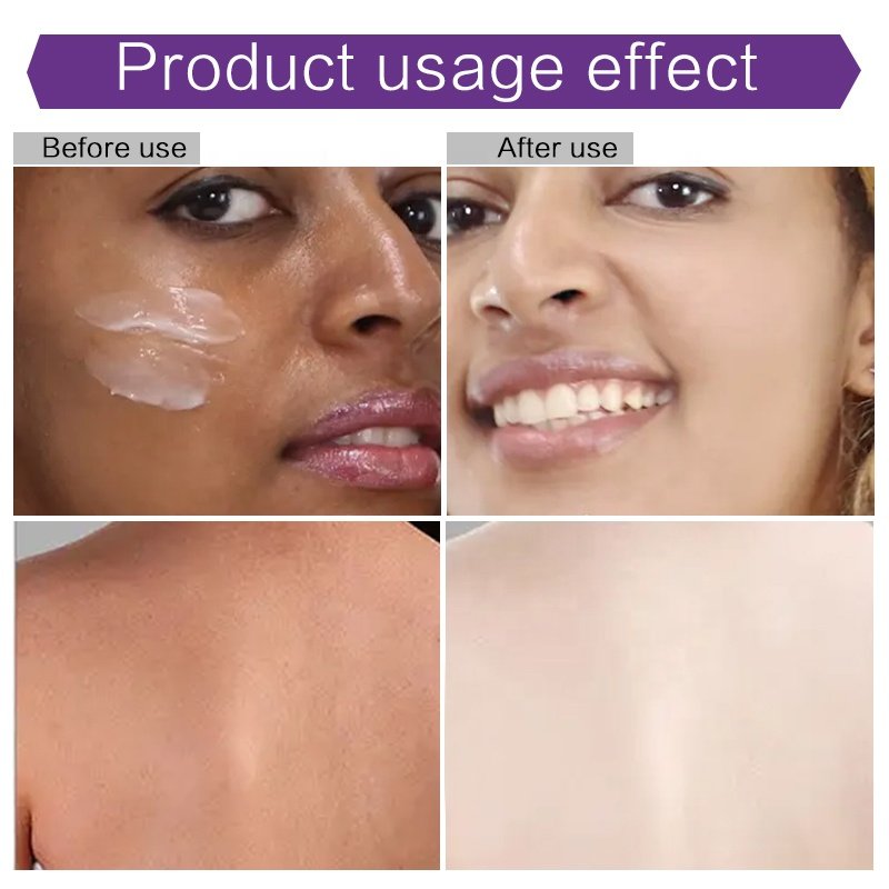 Best Body Care Skin Silky Touch Whitening Brightening Bulk Lotion Natural Bleaching Body Lotion