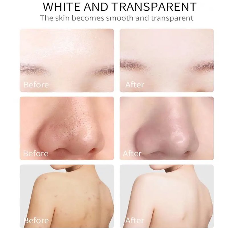 Best Selling Kojic Acid Skin Care Set (new) Hydrating Anti Aging Scars Dark Spot Remover Brightening Lotion Facial Serum Cream