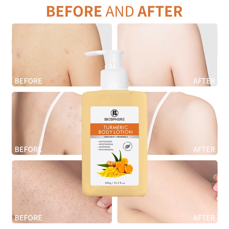 Skin Brightening Vegan Turmeric Whitening Biosphere Beauty Magic Hand Shimmer Acne Lotion Australian Tea Tree Oil Body Lotion