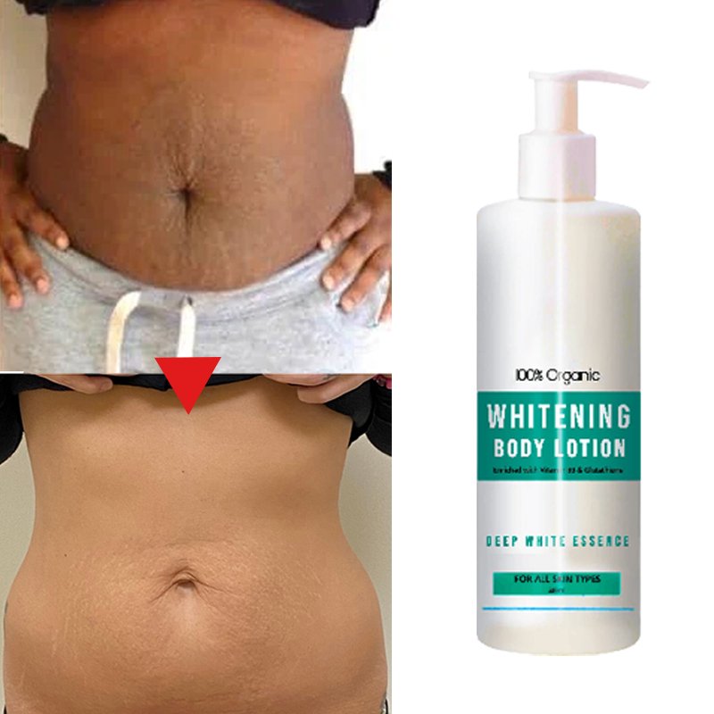 new arrival nicotinamide strong bleaching cream,woman private parts fast whitening black remover,oem snow bleaching body lotion