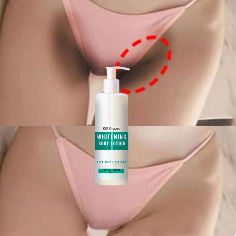 new arrival nicotinamide strong bleaching cream,woman private parts fast whitening black remover,oem snow bleaching body lotion